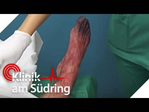 Massieren Sie Ihre Füße wieder mit Schmerzen im unteren Rücken Wie die Größe der Knieorthese wählen
