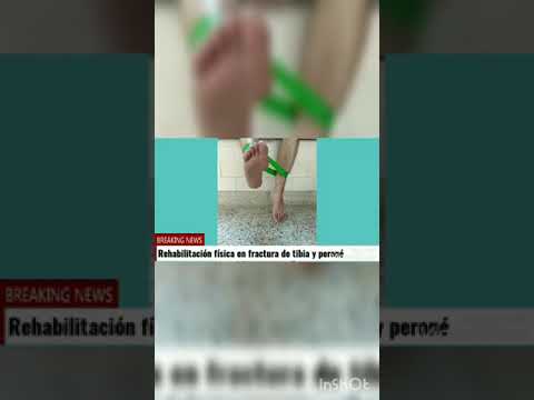 EJERCICIOS DE REHABILITACIÓN FÍSICA EN FRACTURA DE TIBIA Y PERONÉ