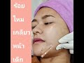 ร้อยไหม หน้าเรียว