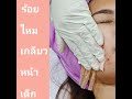 ร้อยไหม หน้าเรียว