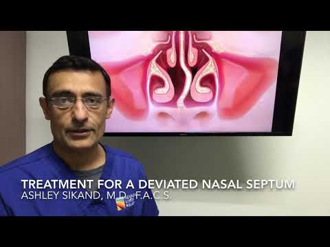 Treatment For A Deviated Nasal Septum