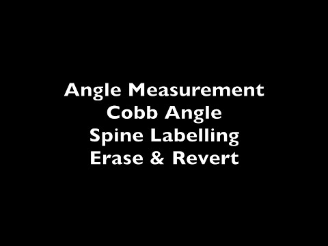 11. Markup Function II - Angle Measurement, Cobb Angle, Spine Labelling, Erase and Revert