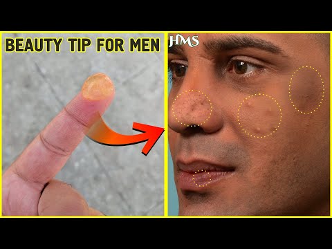 Beauty Tips For Men | पुरुषों की त्वचा को गोरा करने और दाग धब्बे हटाने के असरदार नुस्खे Video