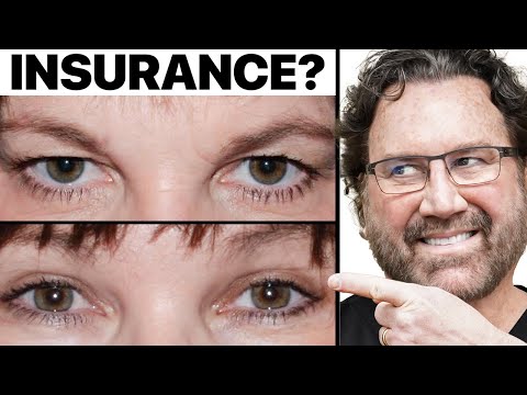 Is Eyelid Surgery Covered By Insurance? Surgeon Answers