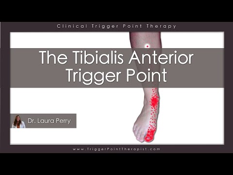 The Tibialis Anterior Trigger Point