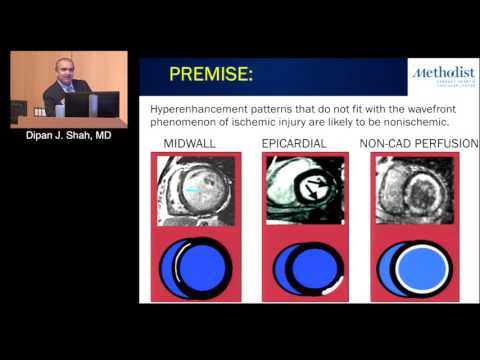 The Role of Cardiac MRI in Heart Failure (Dipan J. Shah, MD)
