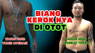 Download lagu REAL STORY: A Sloping Road Diagnosed with HNP, Turns Out This Muscle Is the Culprit! #kangabay #r... mp3