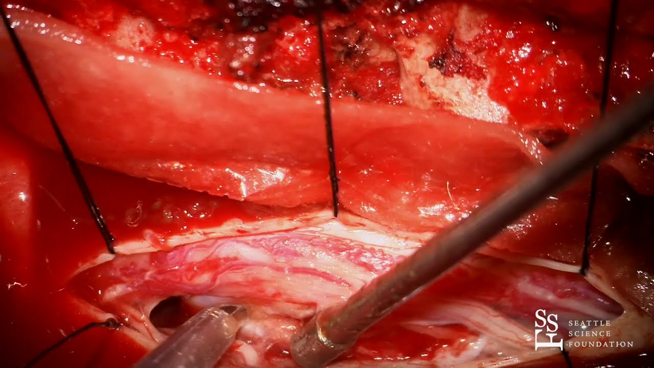 Live Surgery