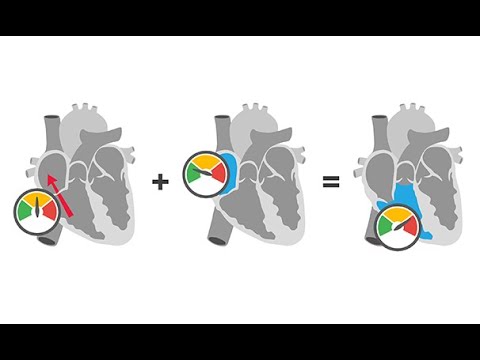 Inferring right heart pressures with echocardiography using tricuspid regurgitation