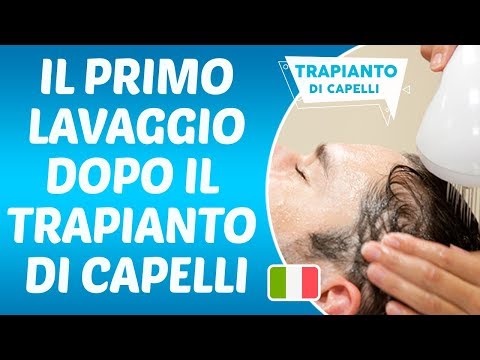 Il Primo Lavaggio Dopo Il Trapianto Di Capelli - Dr. Hamid AYDIN