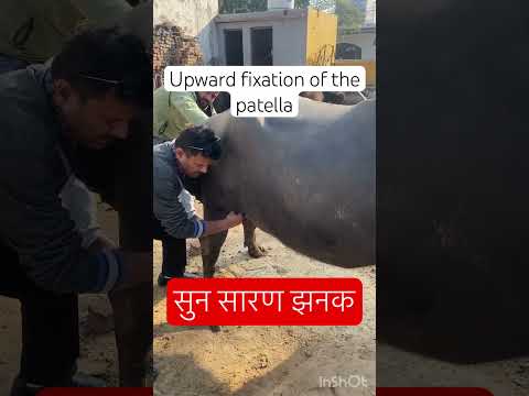 MPD l upward fixation of the patella l dr umar khan