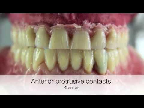 Brock Vandor Kunstzahnwerk 2017 Art of Denture