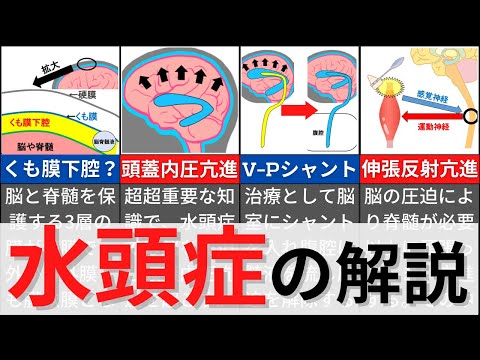 両頭症について詳しく解説