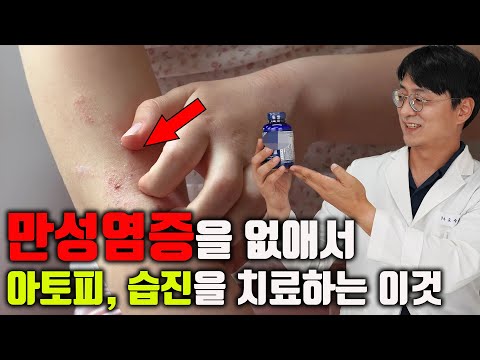 만병의 근원 '만성염증'을 없애서 '아토피, 습진' 등의 피부염을 낫게 하는 이것 (염증 조절, 면역균형 개선, 항산화 영양제)
