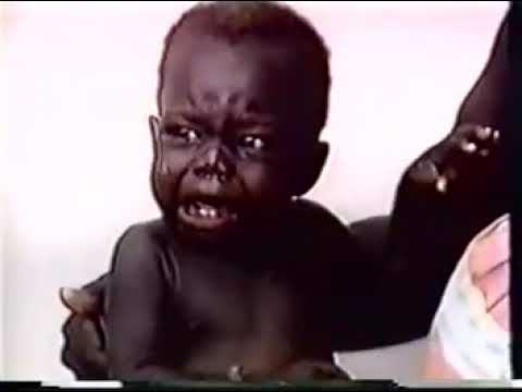 KHÁM DẤU HIỆU NGUY HIỂM TOÀN THÂN