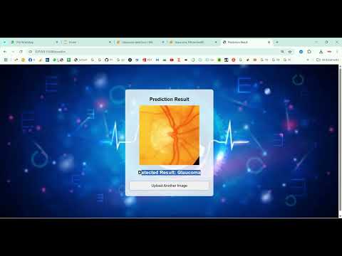 Glaucoma Detection CNN in Python Projects