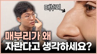 매부리가 왜 자란다고 생각하세요?