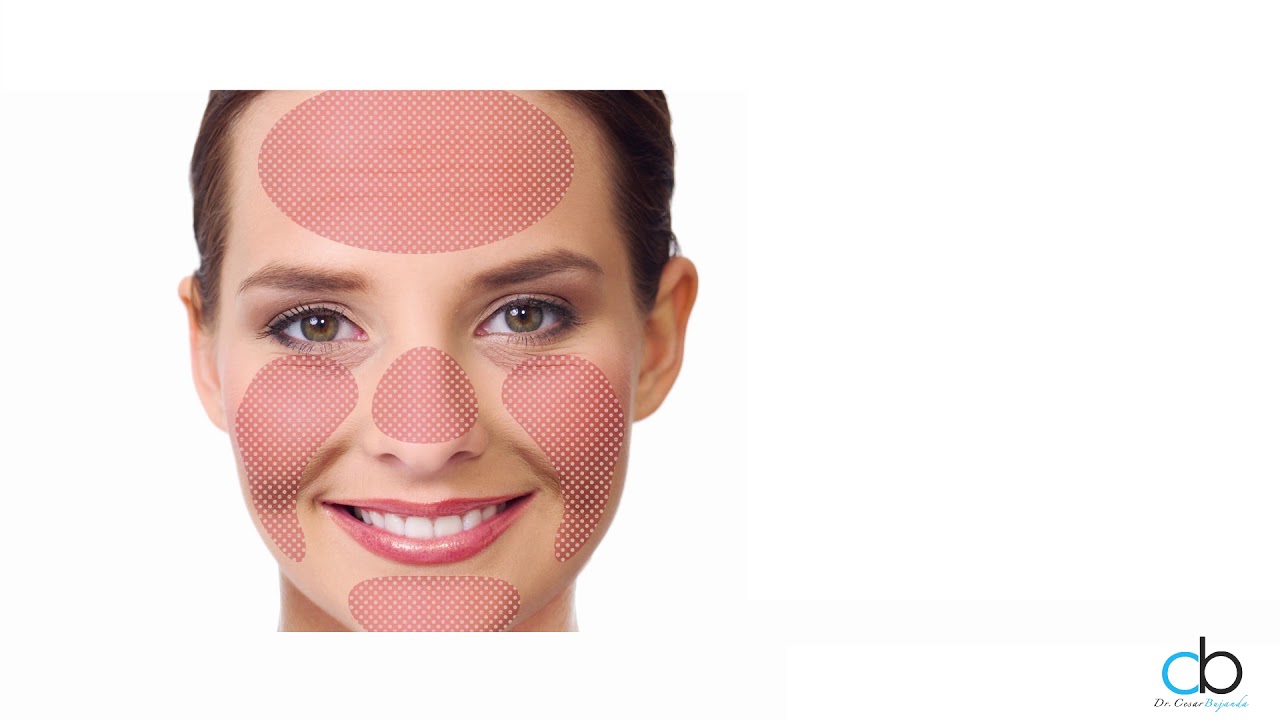 César Noé Bujanda Mena-21