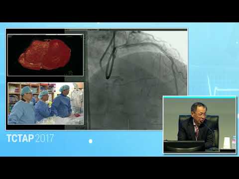 [TCTAP 2017] CTO Live - Live Case Session I