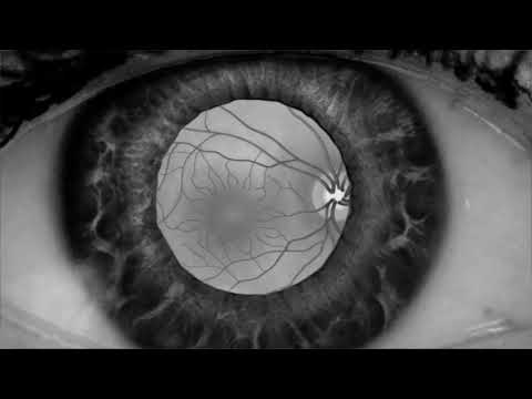 Play Video Youtube Video