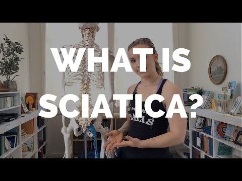 Sciatica and Sciatic Nerve Pain Explained
