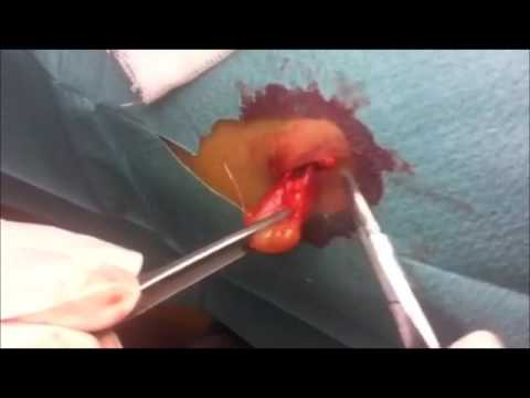 Gel equine di dolori alle ginocchia e le articolazioni Mal di schiena dà nelle uova