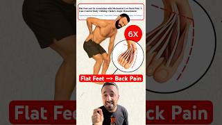 How Flat Feet Cause Lower Back Pain