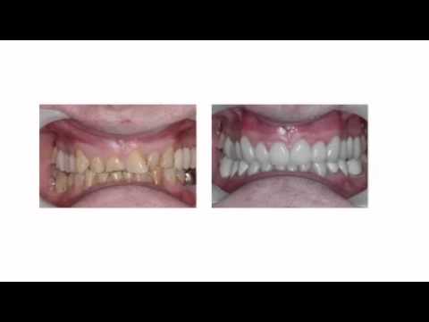 Dentist Brentwood - Devonshire House Dental Surgery