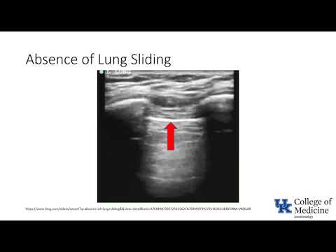 Keyword Review: Respiratory: Lung Ultrasound - (Dr. Bowe)
