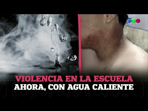 QUEMÓ a un COMPAÑERO de ESCUELA con AGUA CALIENTE #ElNotidelaGente