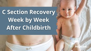C Section Recovery Week by Week After Childbirth