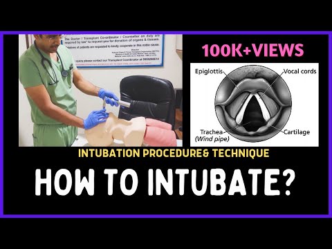 HOW TO INTUBATE? INTUBATION PROCEDURE & TECHNIQUE