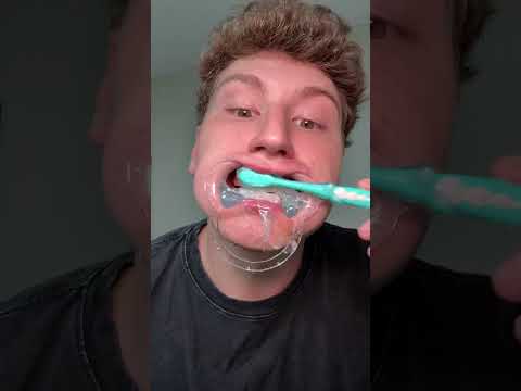 This is crazy #toothpaste #teeth #whitening #bodyaccel #sale