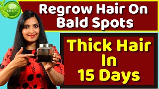 STOP HAIR FALL / REVERSE BALDNESS /  100% Natural PROVEN Method / Tried N Tested  For Hair Regrowth