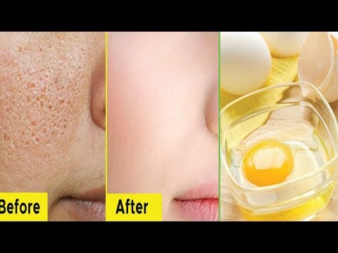 بياض بيضة واحده وسوف تختفي المسامات الواسعه الي الابد هنا hana