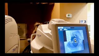 Detailed Eye Exam - Looking Inside My Eye (Vlog 92)
