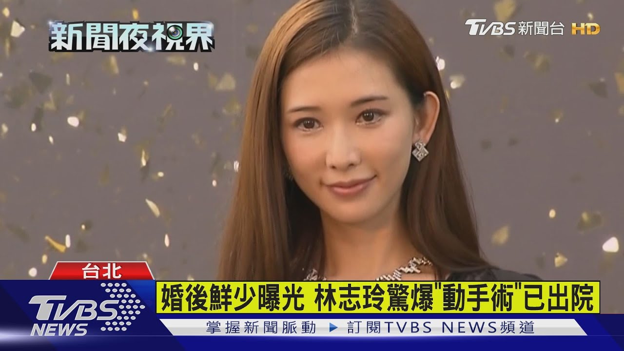 支氣管常過敏 經紀人證實林志玲「動刀」