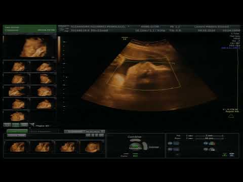 VIDEO EMOCIOANAL CON LIAM - 5D EMOCIONAL - 09-03-2024