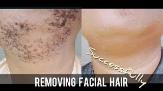 Chin hair - BEST FACIAL HAIR REMOVAL: avoid razor bumps when shaving women