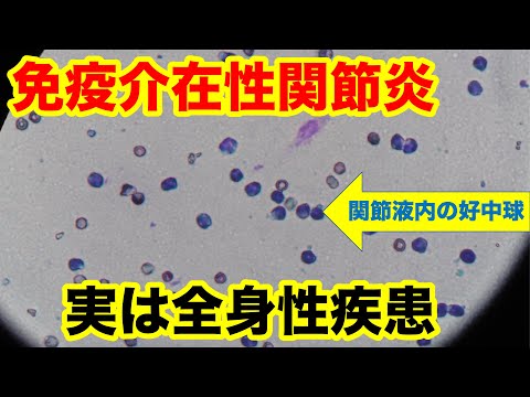 犬の関節炎 - 臨床症状と治療