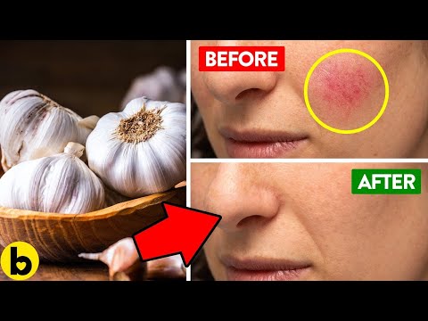 11 Sulfur-Rich Foods You Need To Eat