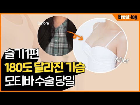 [슬기] 가슴성형 브이로그 1탄 | 가슴확대수술 A컵 → D컵으로 변신 | 윈느성형외과 라벨윈느 유튜브 영상
