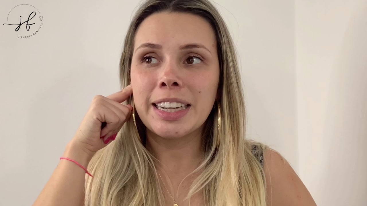 Minha experiência com o INVISALIGN
