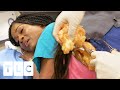 Woman Sings While Dr Lee Removes Her "Talkative" Lipoma | Dr. Pimple Popper Pop Ups