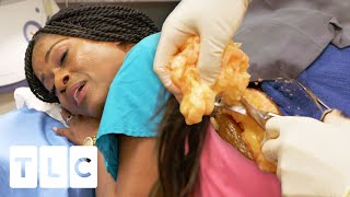 Woman Sings While Dr Lee Removes Her &quot;Talkative&quot; Lipoma | Dr. Pimple Popper Pop Ups