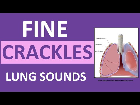 Crackles (Fine) Lung Sounds | Crackles and Rales Breath Sounds Abnormal