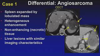ARRS 2015 neuroradiology