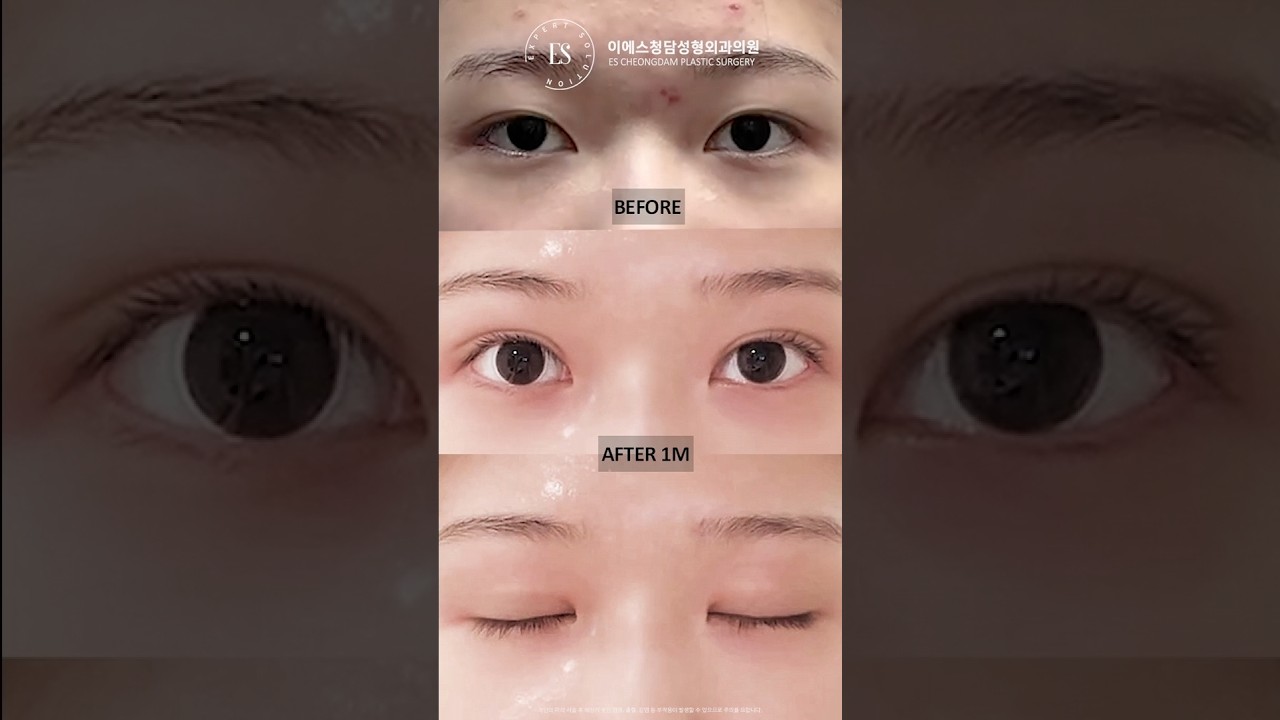 이에스 유튜브