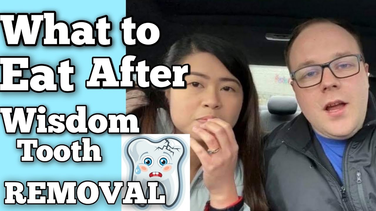 What to EAT After Wisdom Teeth Extraction🦷 | FOOD TO Eat  | Wisdom teeth Extraction