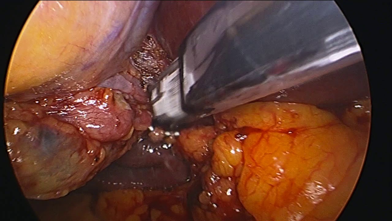 Juan Pablo Marin Calahorrano-4